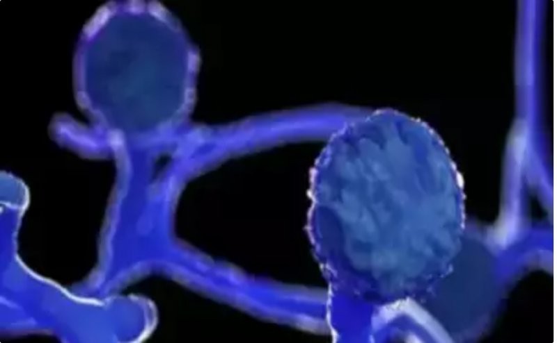 Northeast reports first death due to mucormycosis